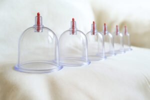 Ventosas terapéuticas alineadas