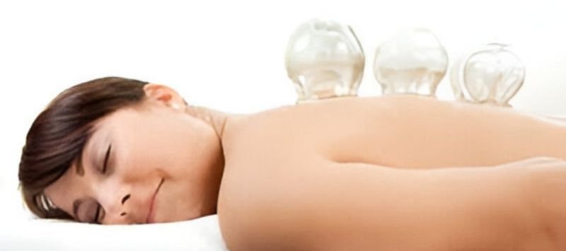 Masaje con ventosas en la espalda de una chica para aliviar dolor y tensiones musculares